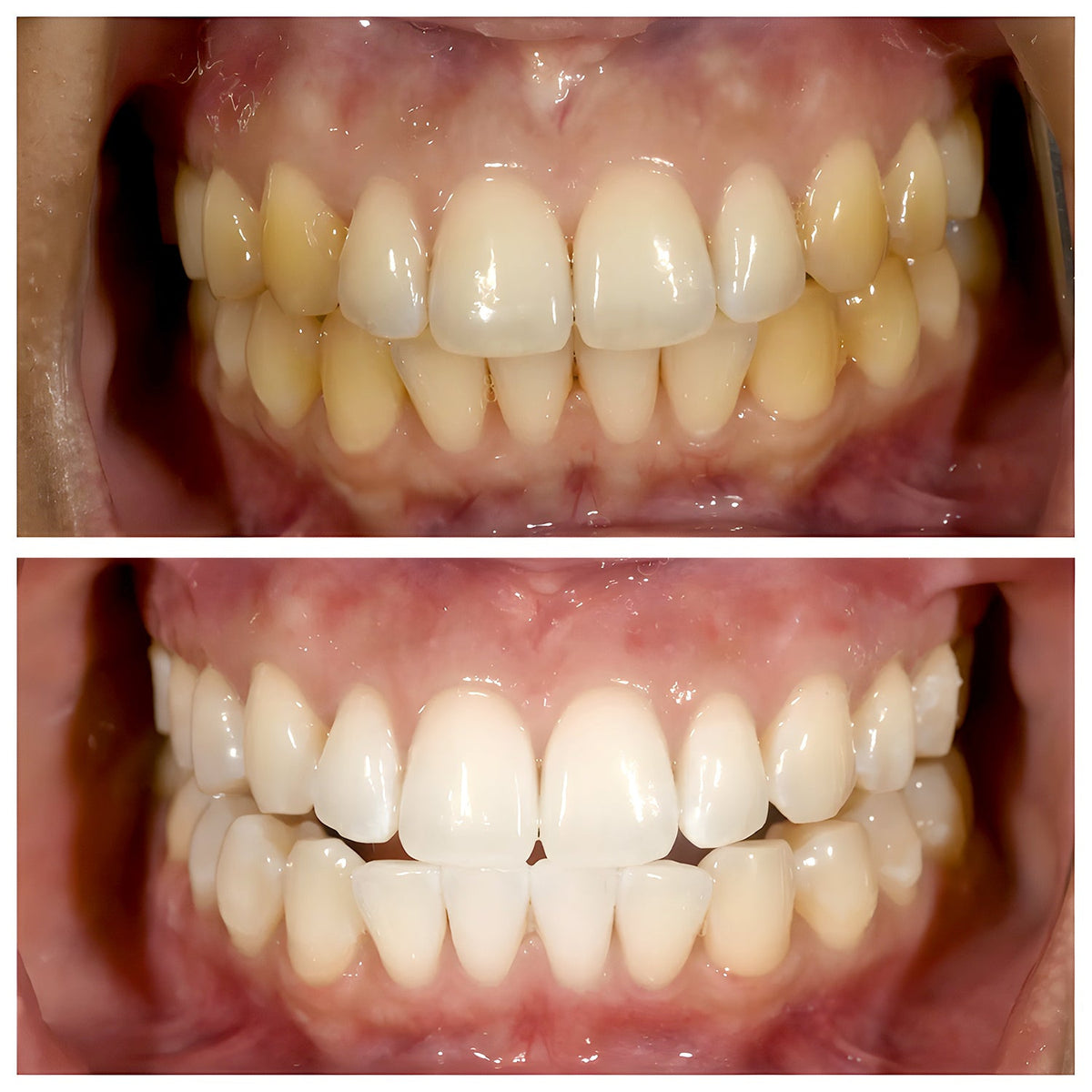 Niacinamide Whitening Toothpaste - TriBright